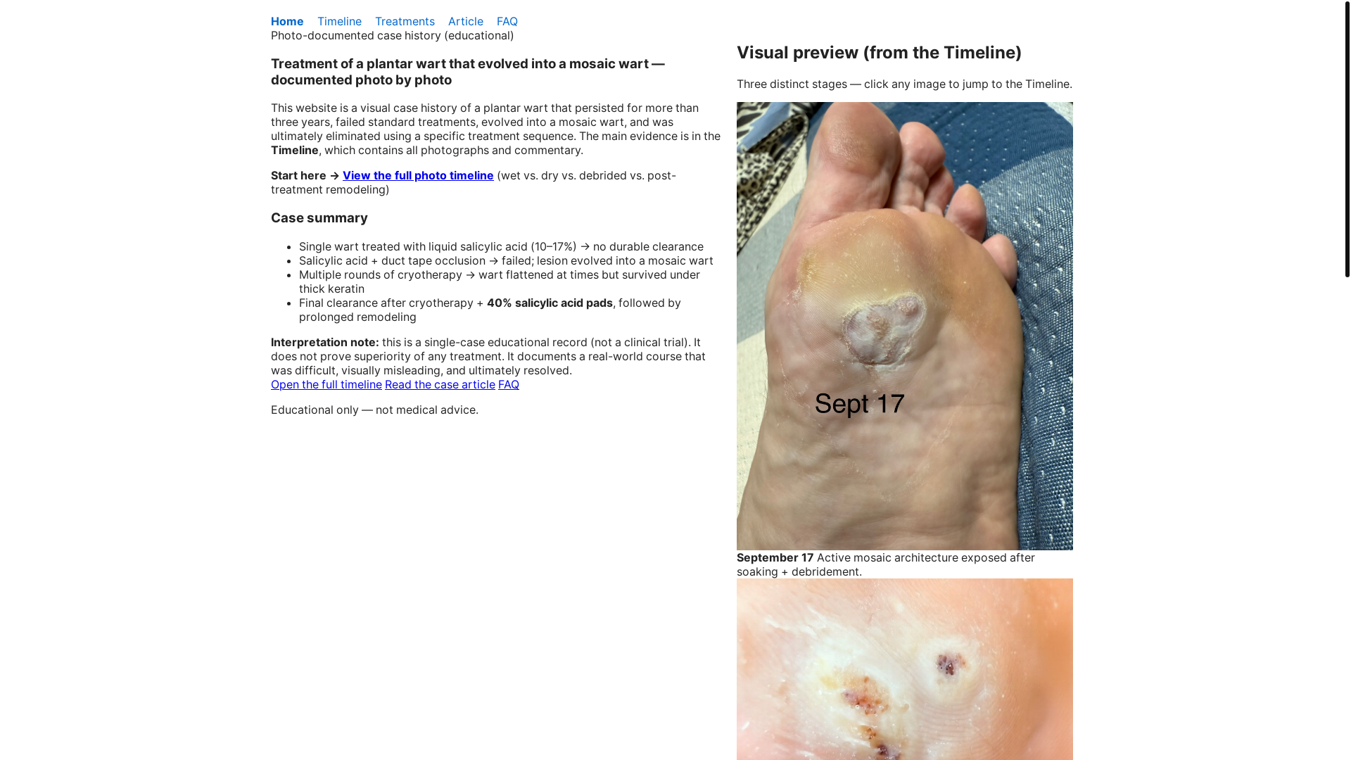 website screenshot of https://plantarwart.pages.dev/