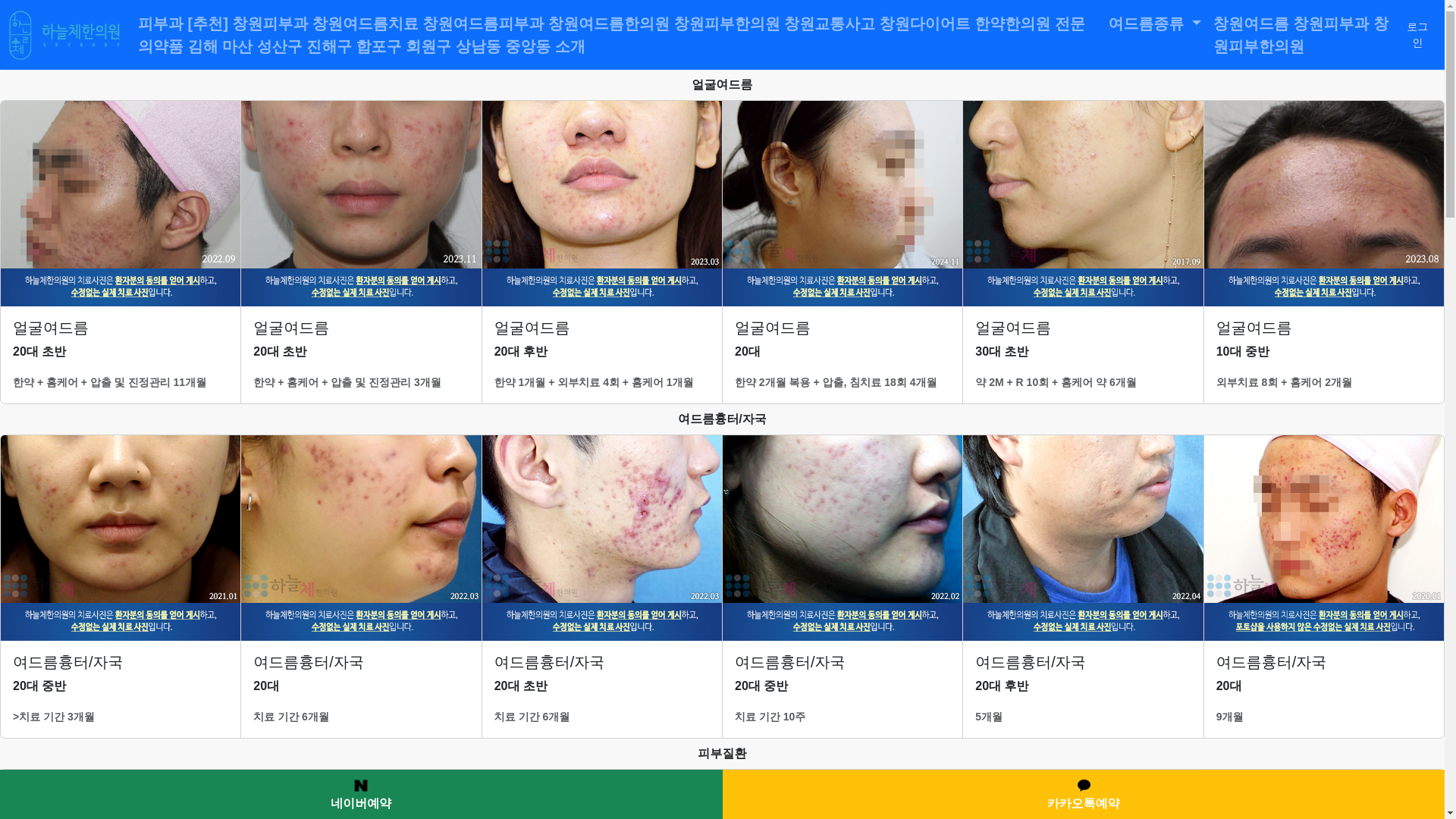 website screenshot of https://changwonpimple.com/