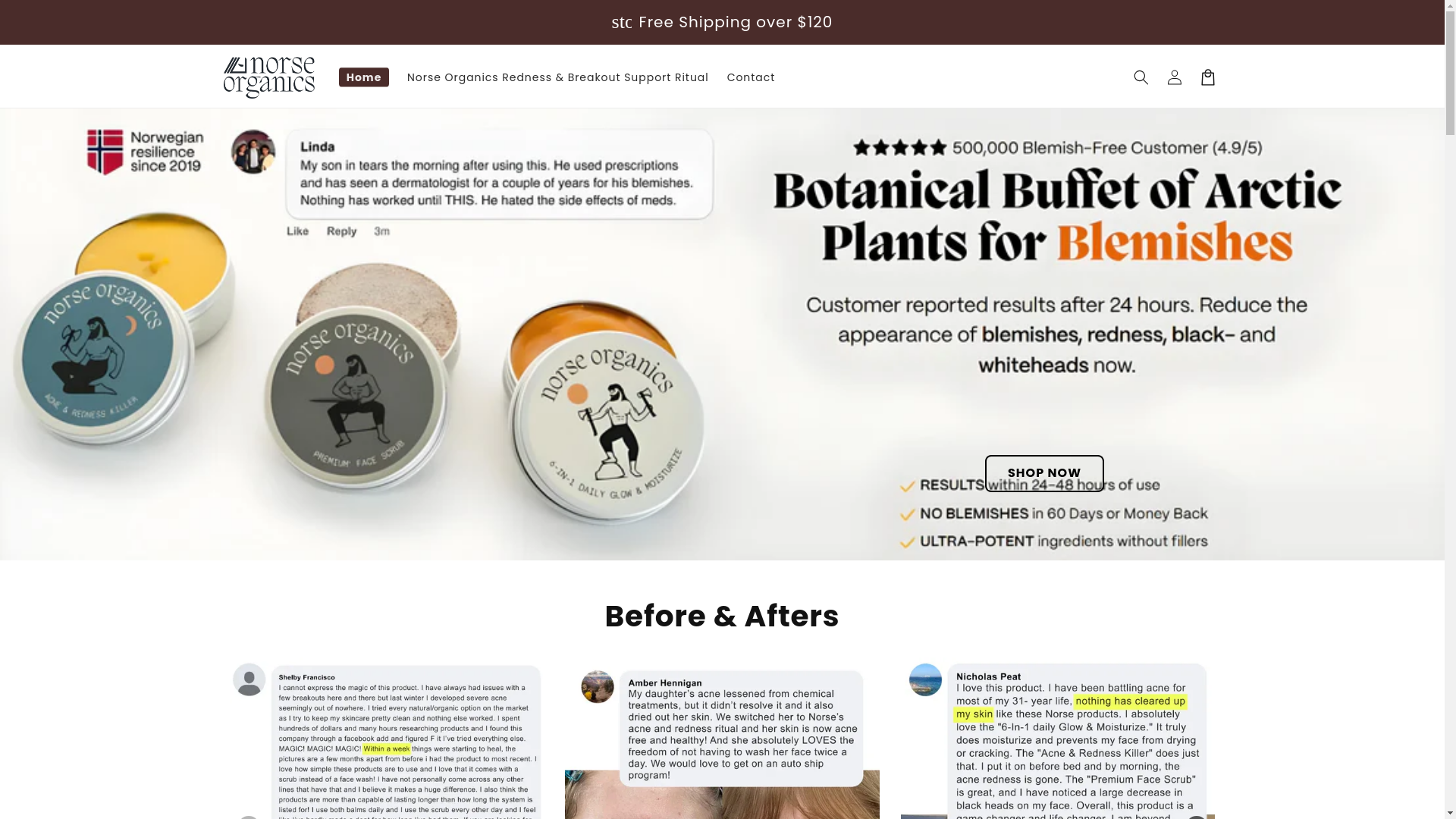 website screenshot of https://norseorganics-acnekiller.store/