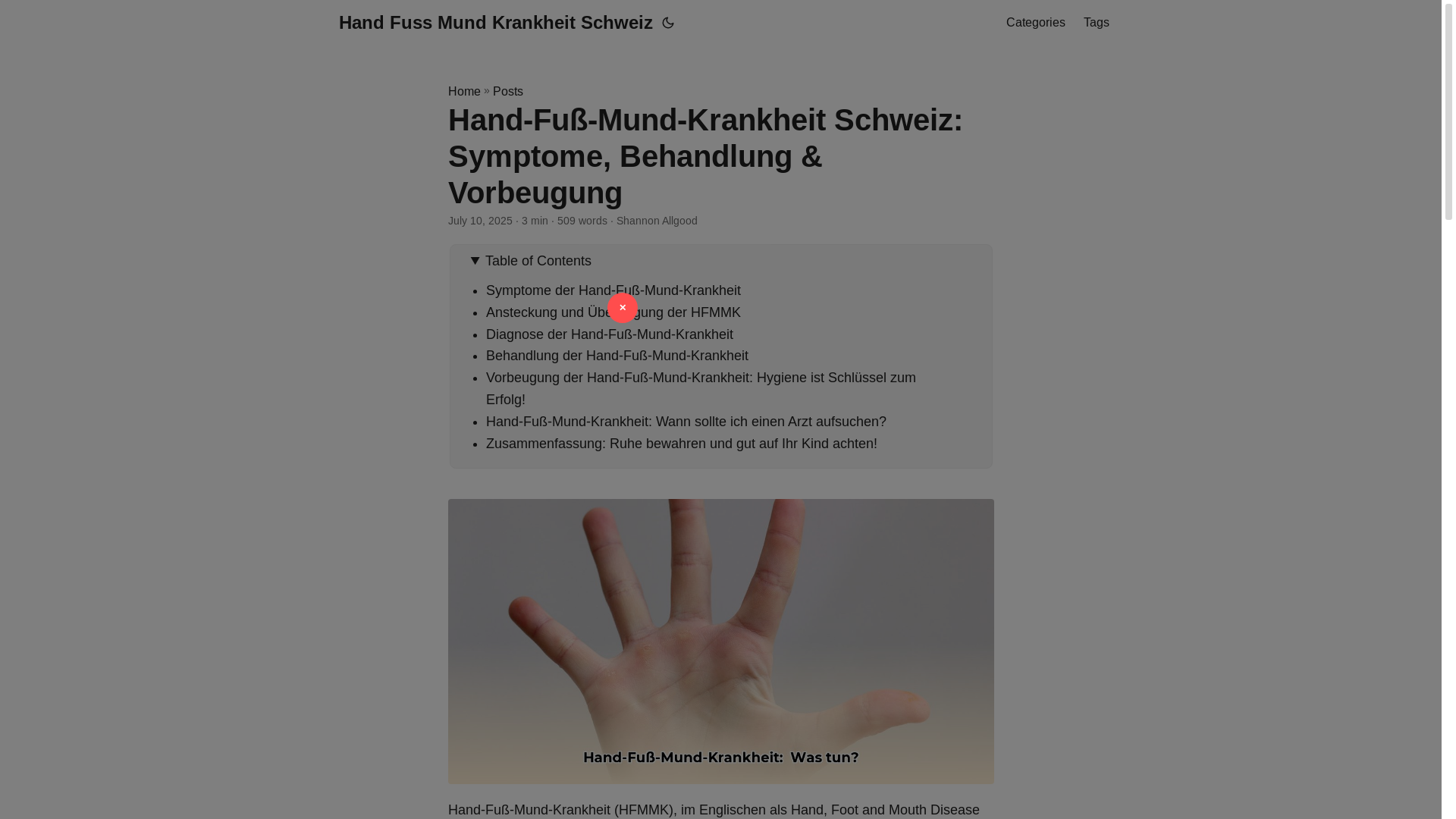 website screenshot of https://hand-fuss-mund-krankheit-schweiz.pages.dev/