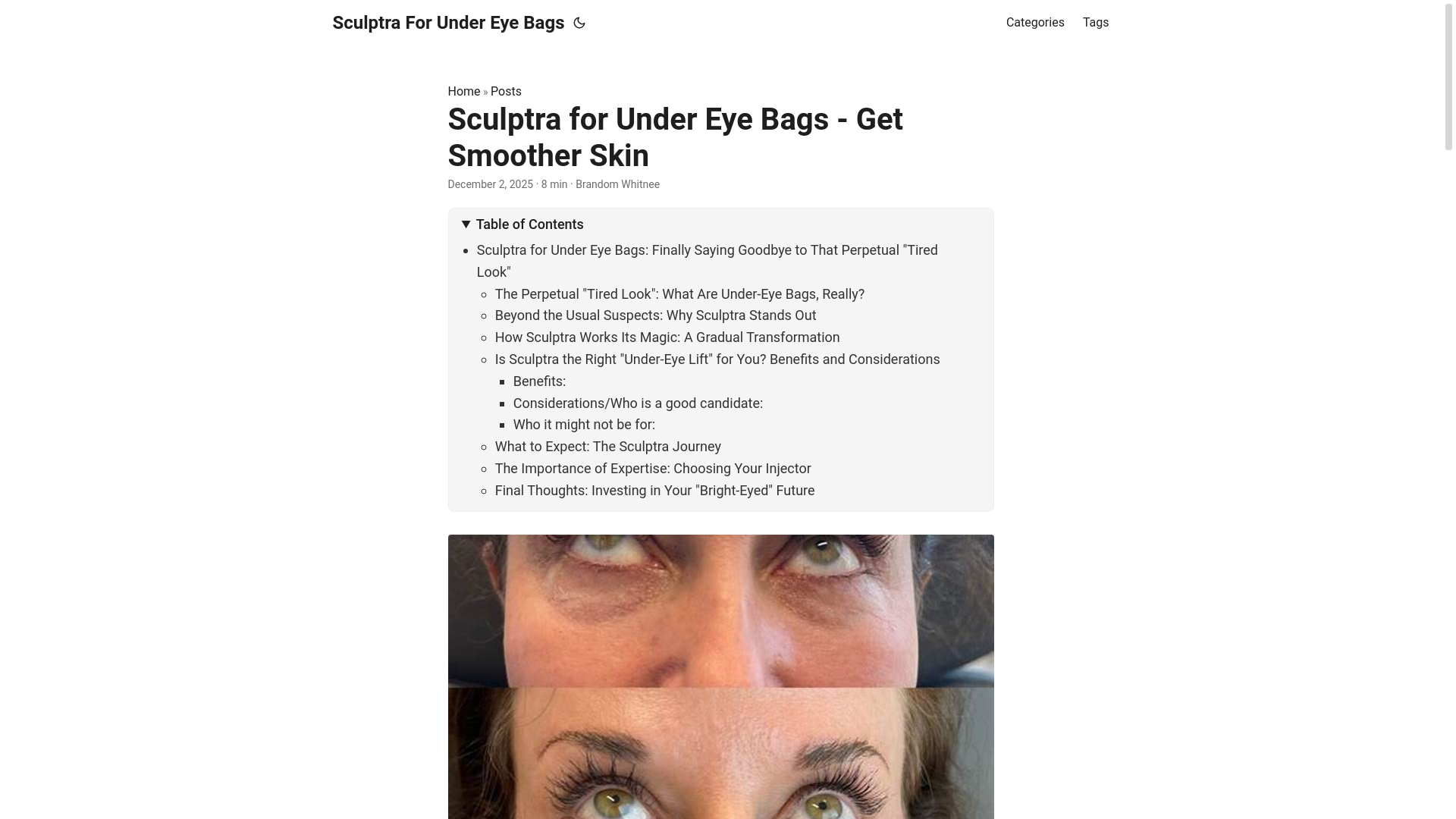 website screenshot of https://sculptraforundereyebags.pages.dev/