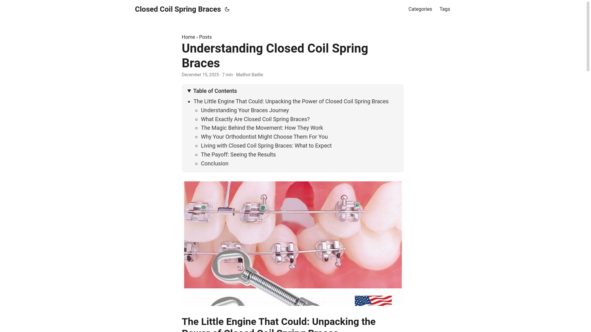 website screenshot of https://closedcoilspringbraces3.pages.dev/