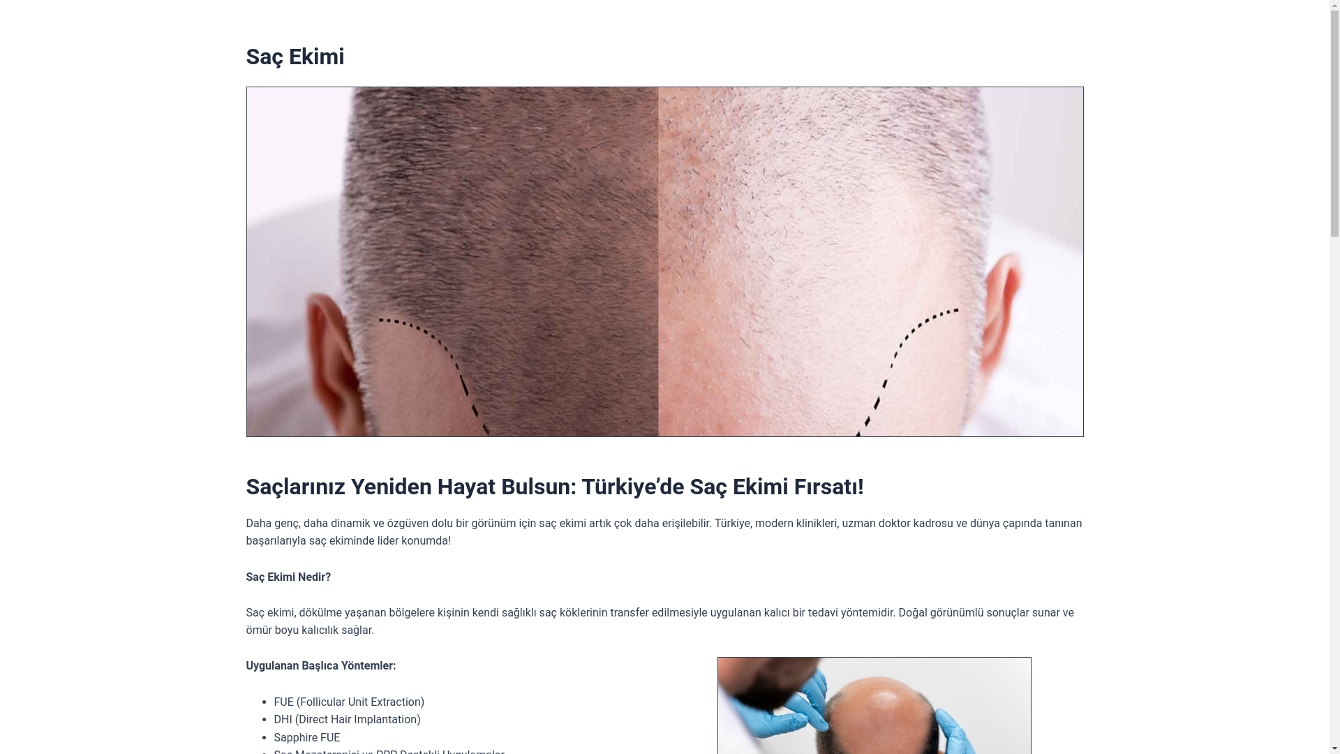 website screenshot of https://medipolp-hair-transplant-tr.pages.dev/