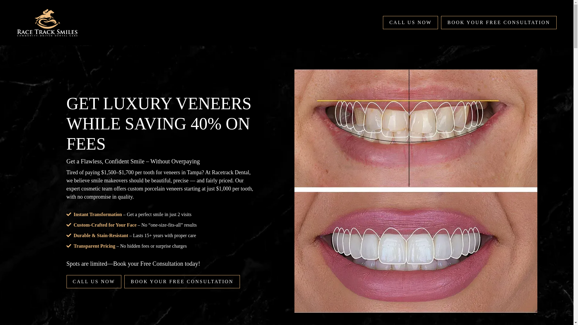 website screenshot of https://veneerstampaflorida.com/