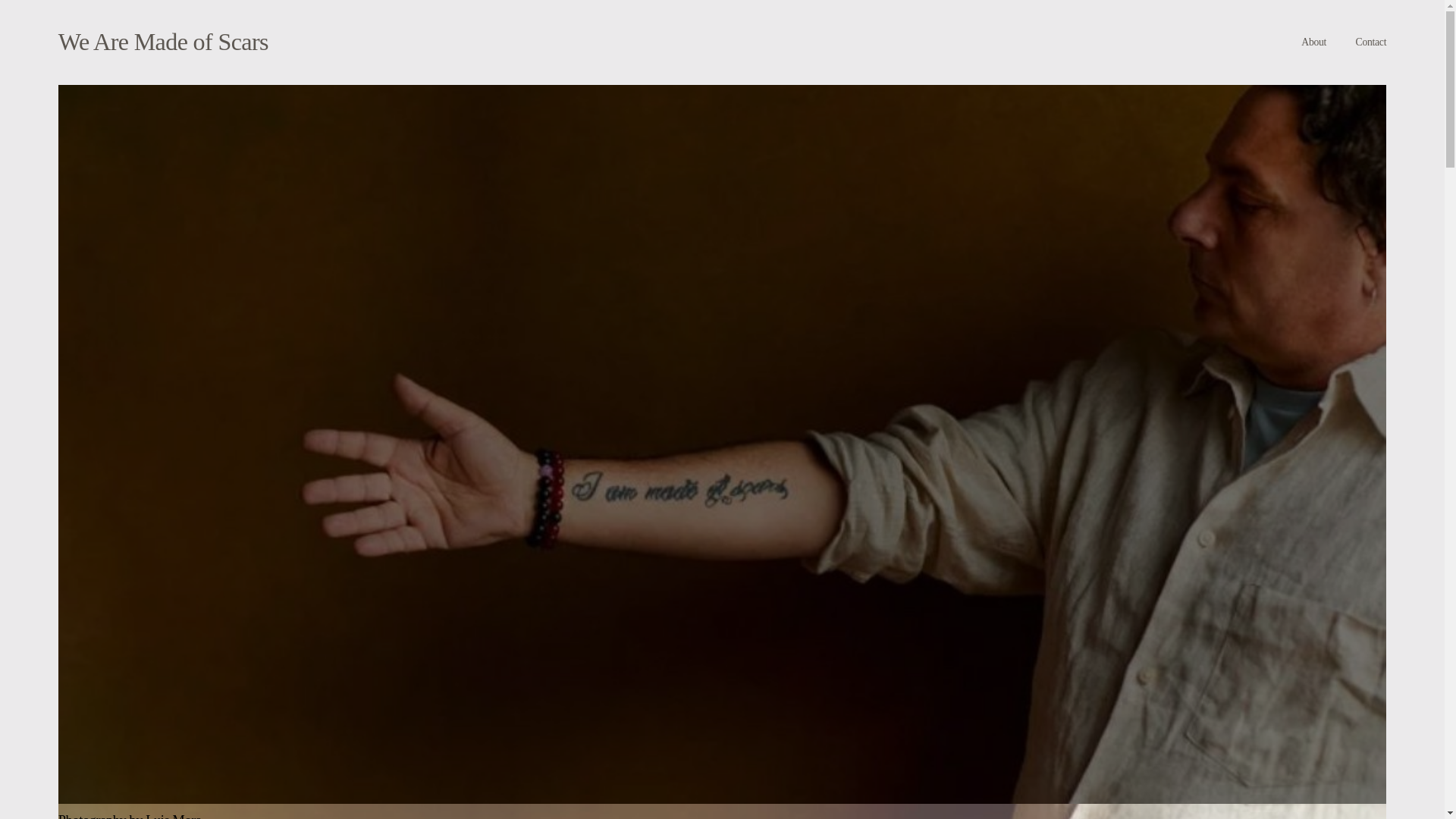 website screenshot of https://wearemadeofscars.ca/