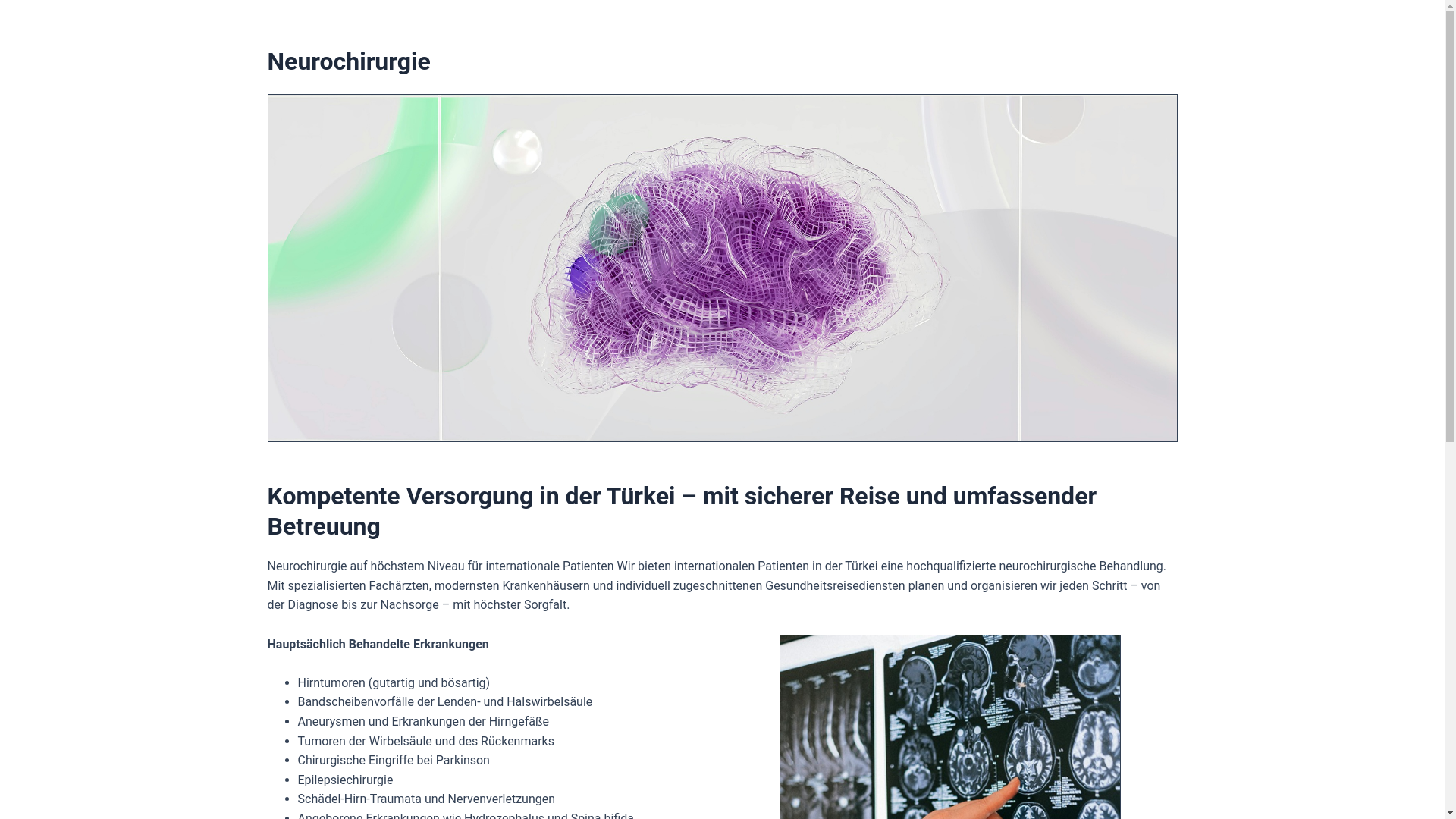 website screenshot of https://medipolpbrainsurgery-de.pages.dev/