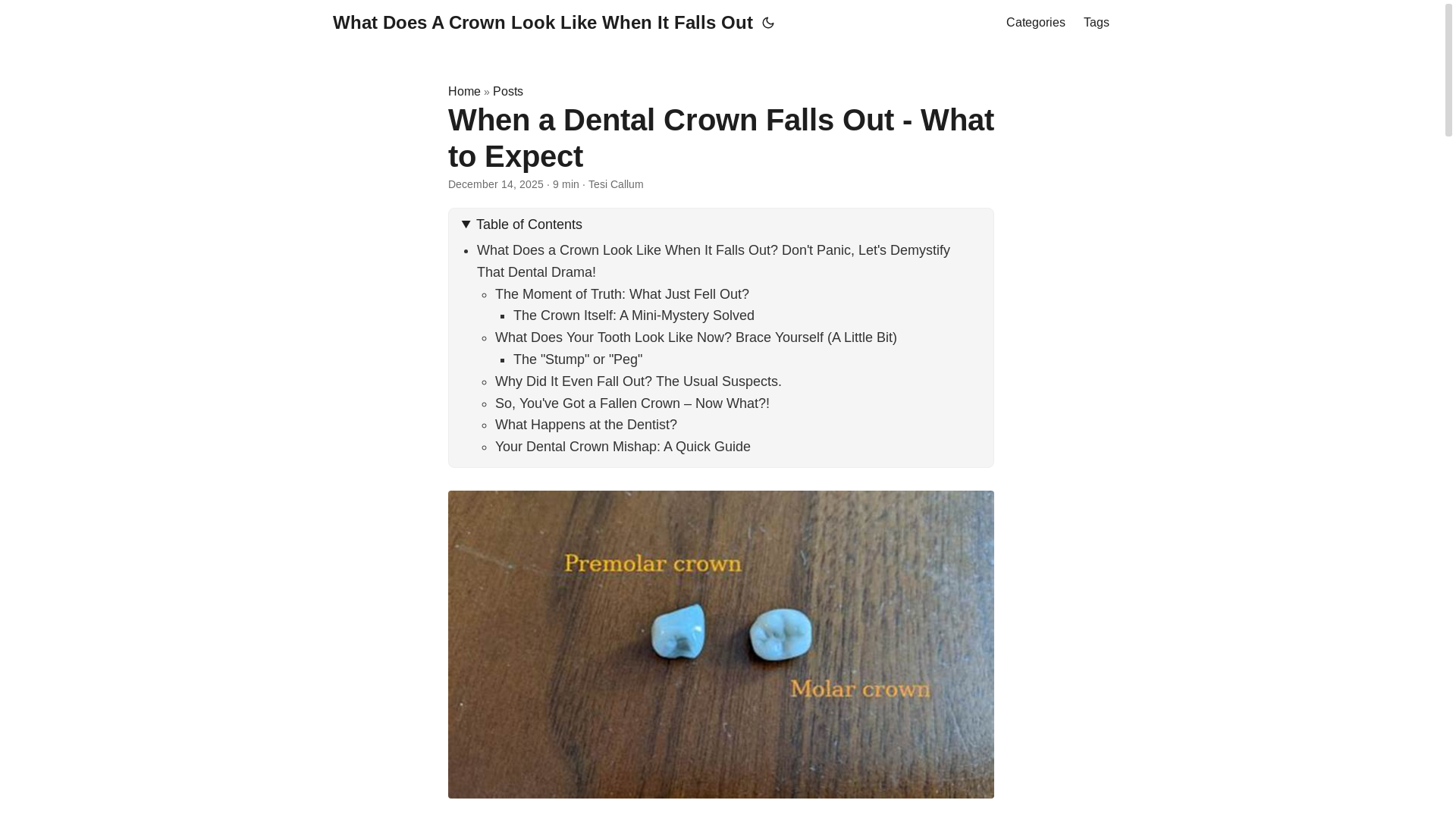 website screenshot of https://whatdoesacrownlooklikewhenitfallsout.pages.dev/