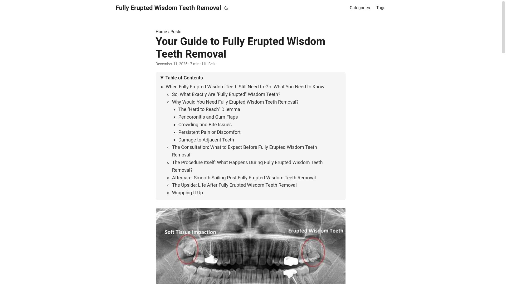 website screenshot of https://fullyeruptedwisdomteethremoval.pages.dev/