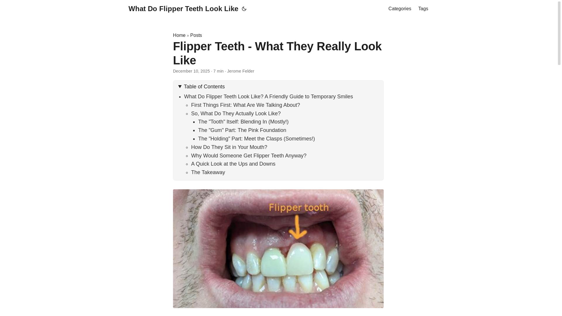 website screenshot of https://whatdoflipperteethlooklike3.pages.dev/