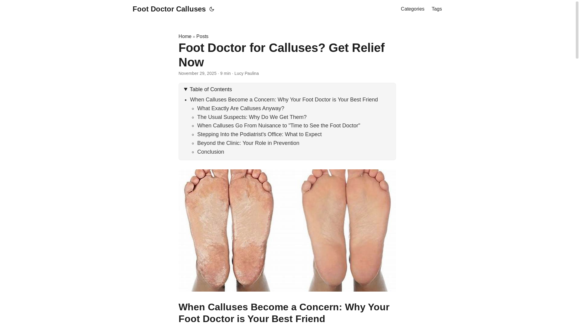 website screenshot of https://footdoctorcalluses7.pages.dev/