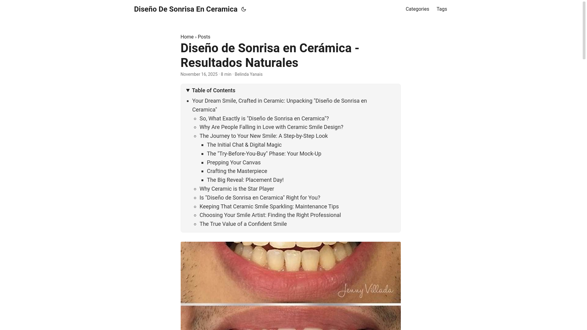 website screenshot of https://diseodesonrisaenceramica.pages.dev/