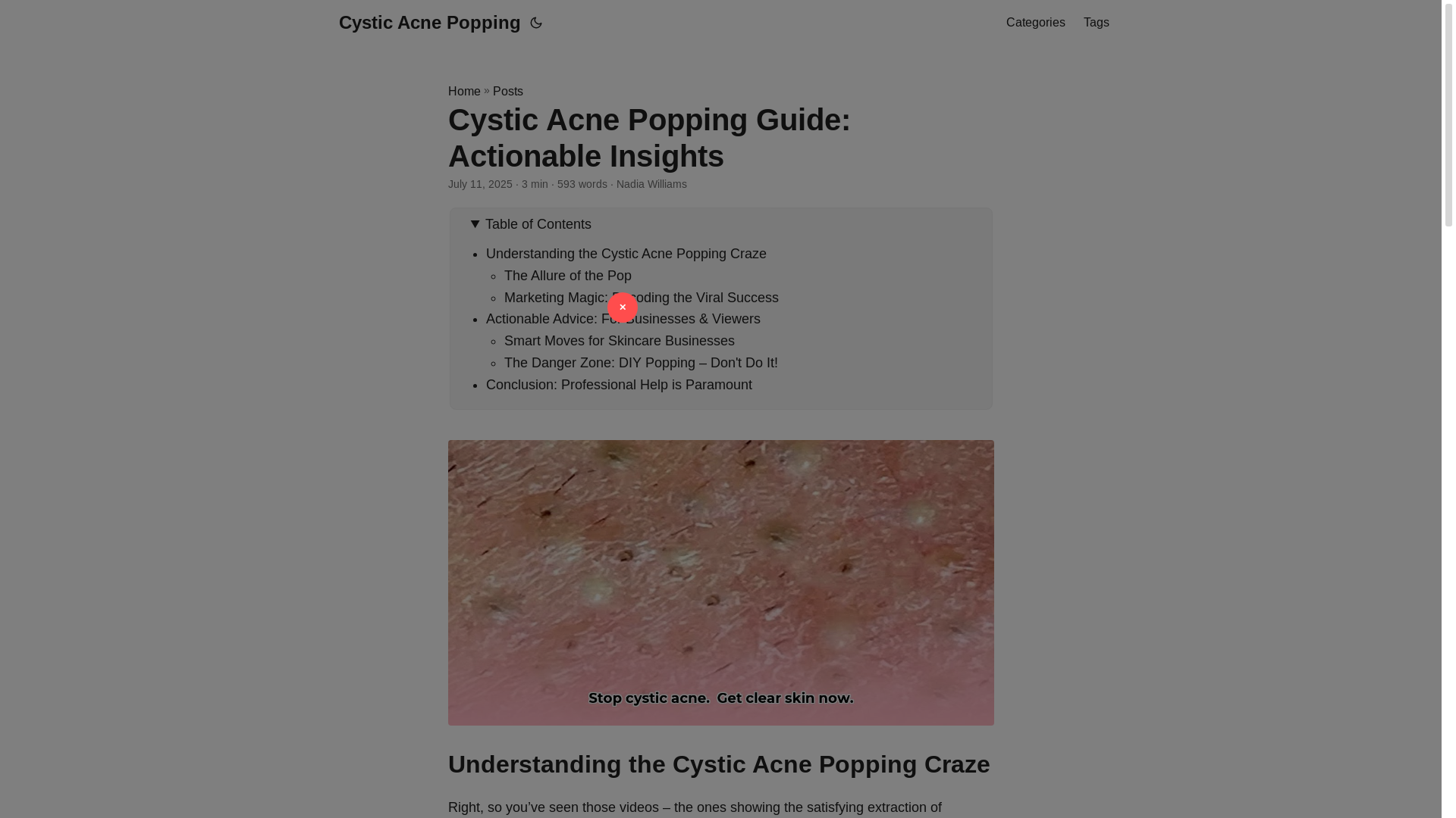 website screenshot of https://cystic-acne-popping.pages.dev/